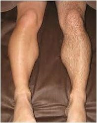 mens leg hair grooming