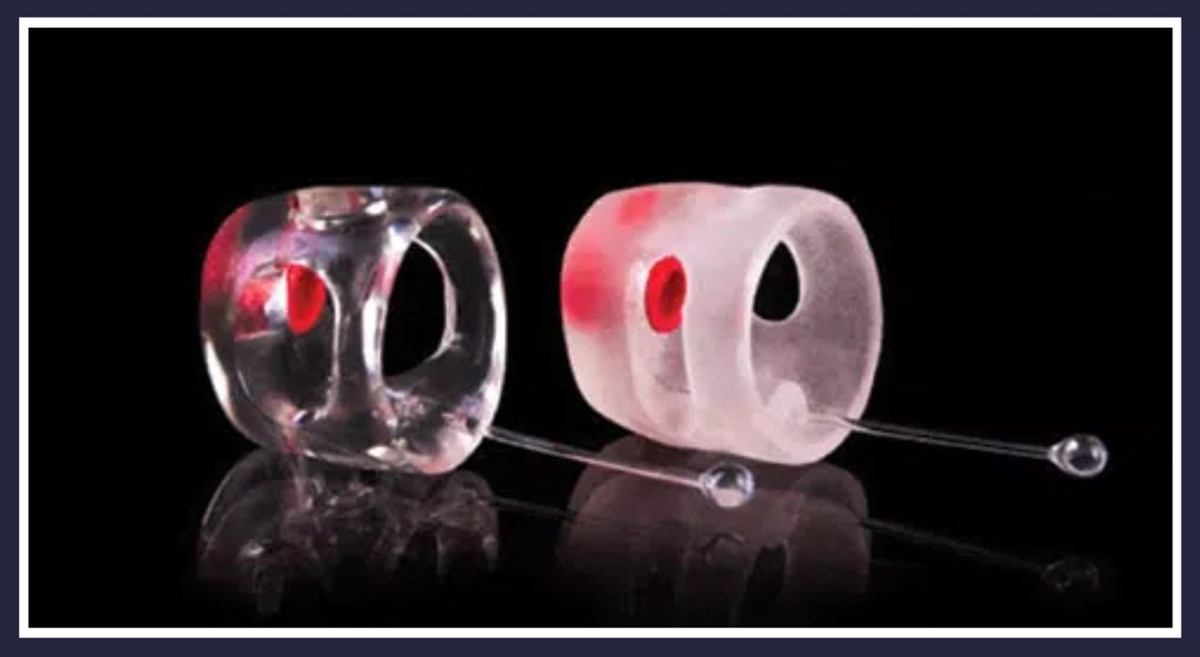 Hearing protection in Tralee, Killarney, and Listowel